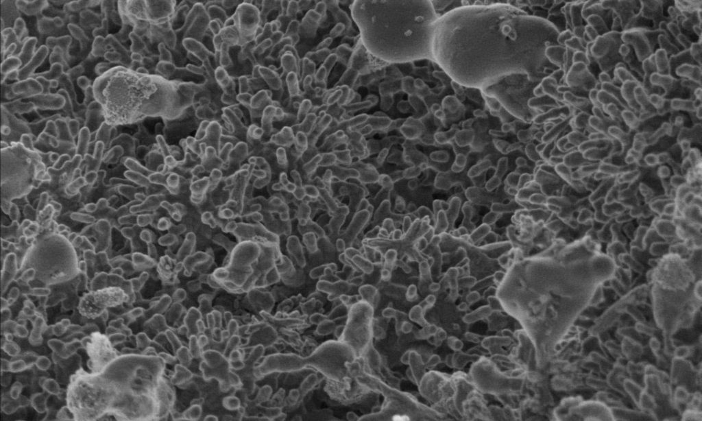 How to Harness the Power of Biosolids to Make Hydrogen 1 RMIT Hydrogen 1